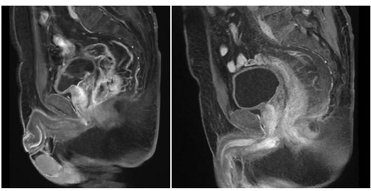 医院购入设备怎么记特别“费”医生的4号机放疗——记腹部放疗一病区MRI-linac Unity临床应用_https://www.jmylbn.com_新闻资讯_第2张