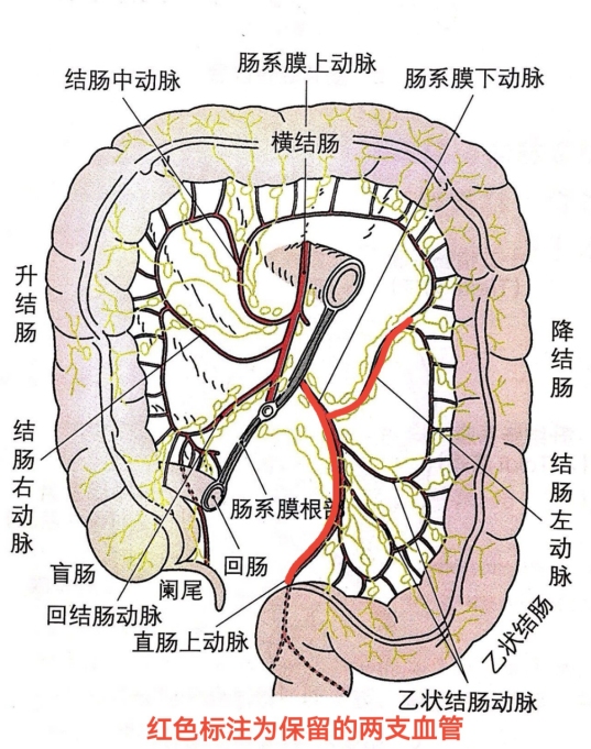 肠双重血供图片