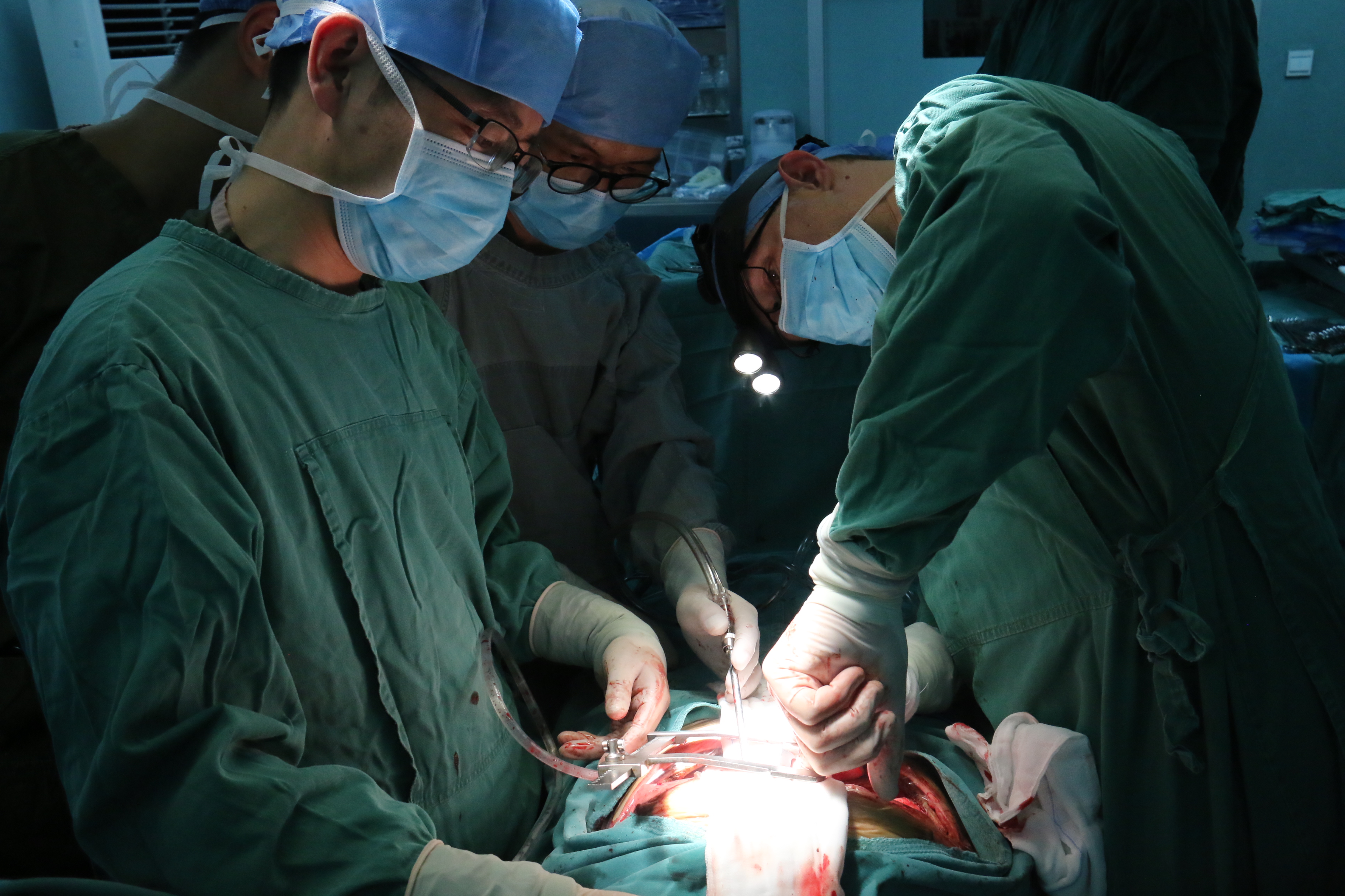 胸外科采用第四代达芬奇机器人完成腔镜微创食管癌根治术-西安国际医学中心医院