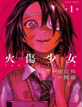 火伤少女