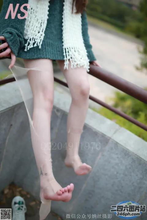 坐在栏杆上的女人的锯齿状腿